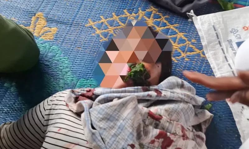 Seorang ibu di Desa Sihaporas mengalami luka pada wajah akibat penyerangan oleh pekerja PT TPL (Foto: dok. Masyarakat Sihaporas).
