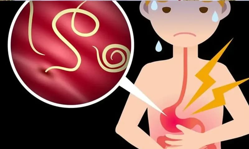 Gejala cacingan (dok klikdokter)