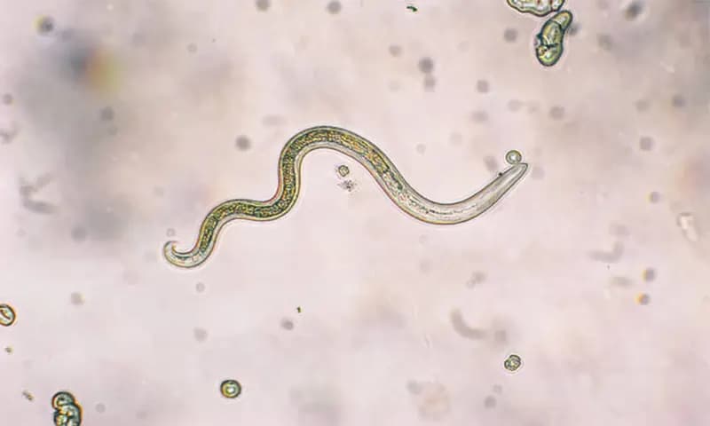 Ciri-Ciri Nematoda (Foto: Pexels/@dotana)