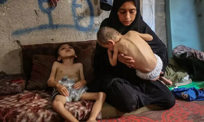 Dua orang anak Palestina yang mengalami malnutrisi dan cerebral palsy di gendong oleh ibunya di tempat pengungsian warga di Gaza, Palestina, Sabtu (25/7/2025). (Foto: Dok. ANTARA)