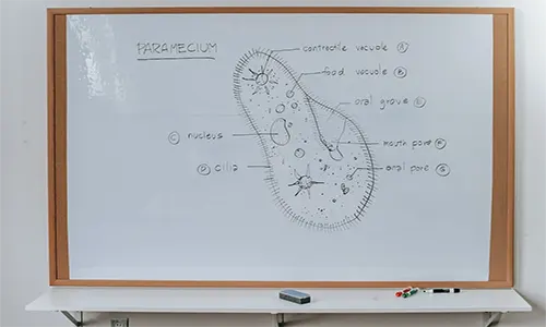 Protozoa adalah